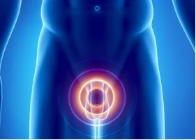 the causes of prostatitis