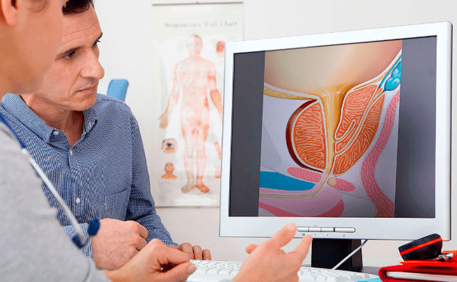 Diagnosis of prostatitis
